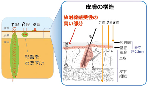 画像：外部被ばく