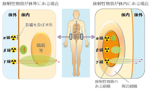 画像：内部被ばく