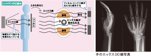 画像：レントゲン撮影